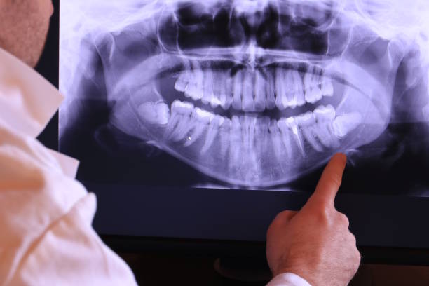 Best Emergency Treatment for Toothache in Diberville, MS